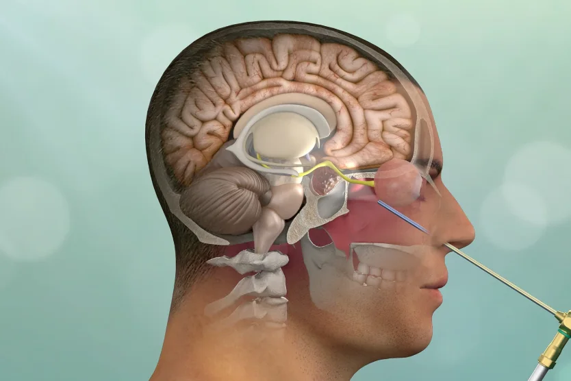 مناظير المخ وقاع الجمجمة